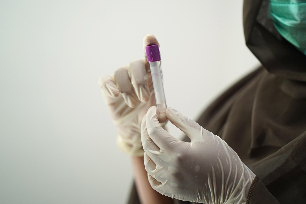 blood test, blood sample, medical technology, medical technologist, surgical gloves, face mask, sample, hospital worker, laboratory, lab, blood test, blood test, blood test, blood test, blood test, sample, laboratory, laboratory, laboratory, lab, lab